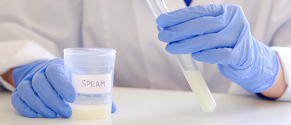 Semen sample being prepared at the laboratory