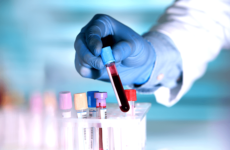 Blood samples for hormonal workup